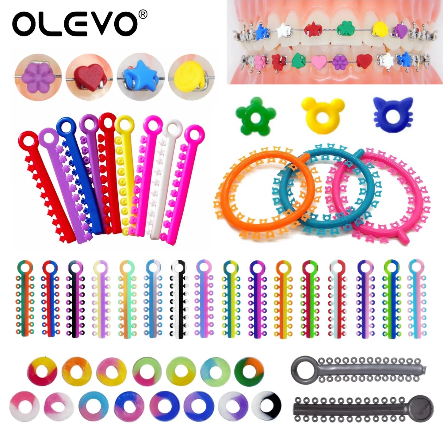 Dental Orthodontic Ligature Ties
