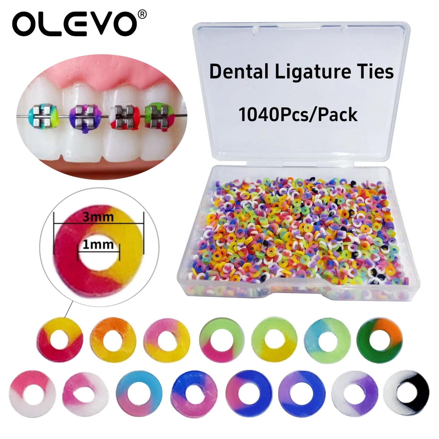 Dental Orthodontic Ligature Ties